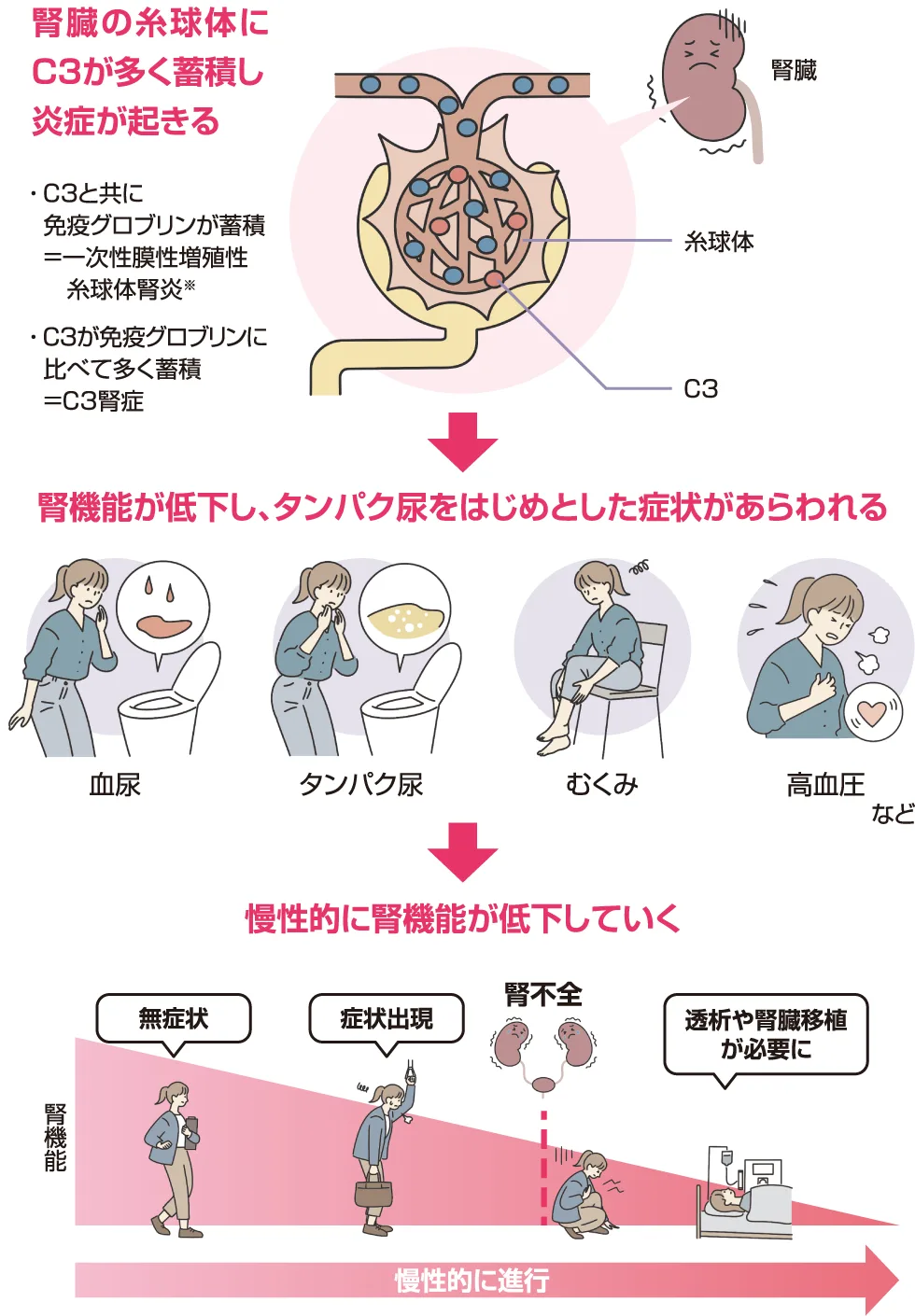 補体系とエムパベリの作用